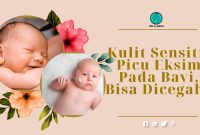 Kulit Sensitif Picu Eksim Pada Bayi