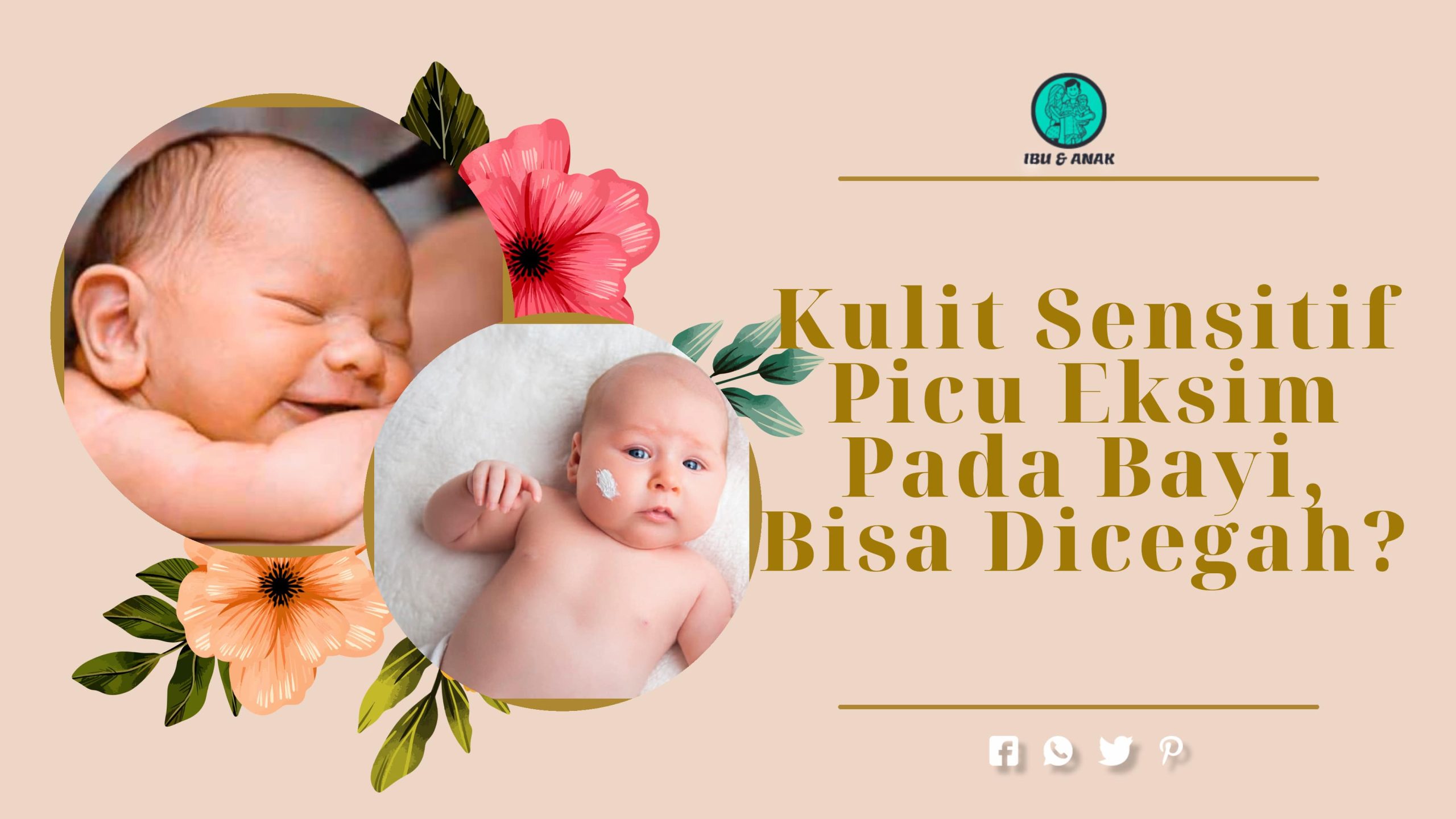 Kulit Sensitif Picu Eksim Pada Bayi