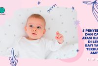 Penyebab dan Cara Atasi Ruam di Leher Bayi